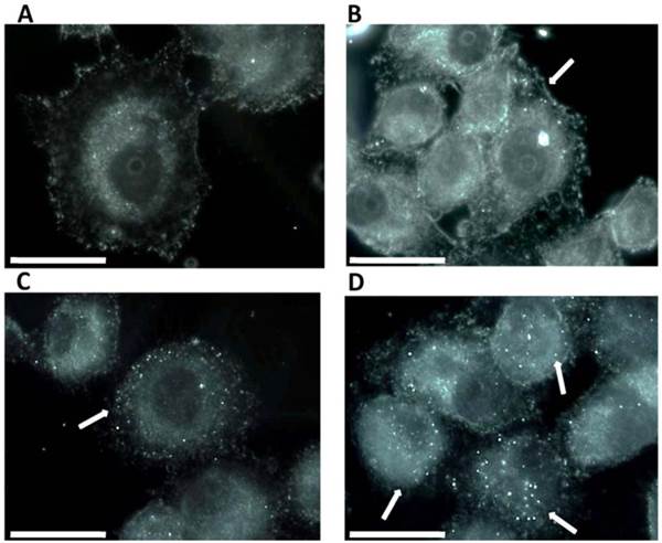 J Cancer Image