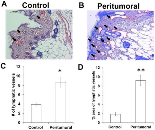 J Cancer Image