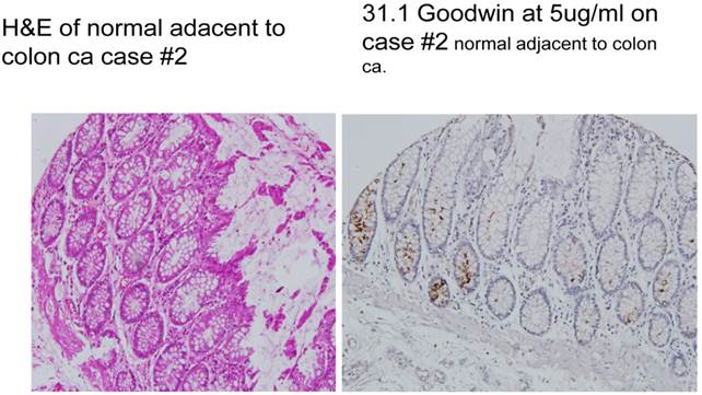 J Cancer Image