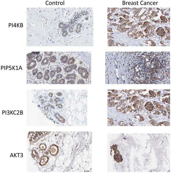 J Cancer Image