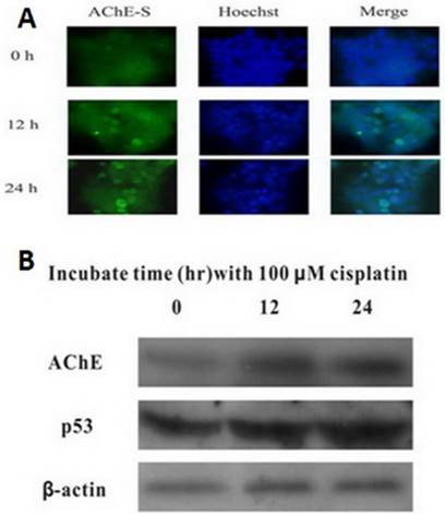 J Cancer Image