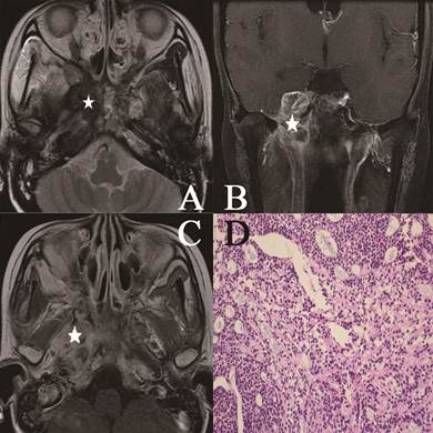 J Cancer Image