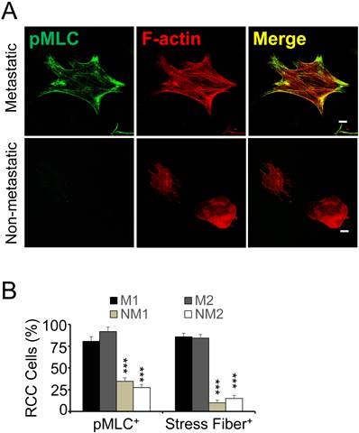 J Cancer Image