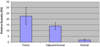 J Cancer Image