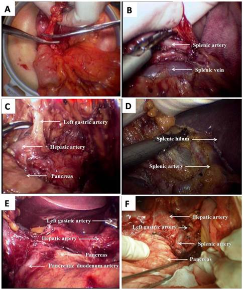 J Cancer Image