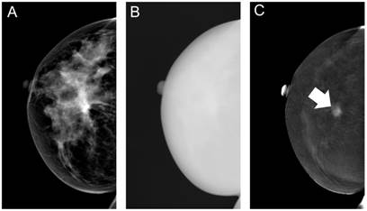 J Cancer Image