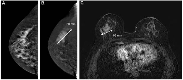 J Cancer Image