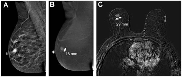 J Cancer Image