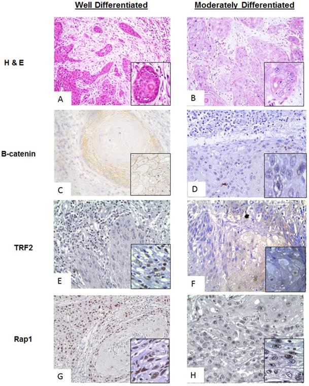 J Cancer Image