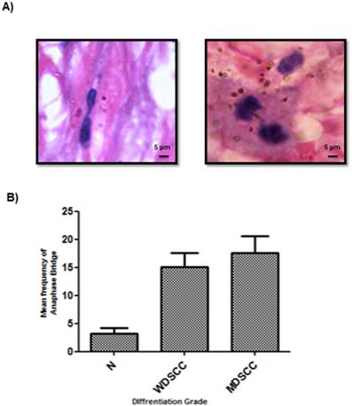 J Cancer Image