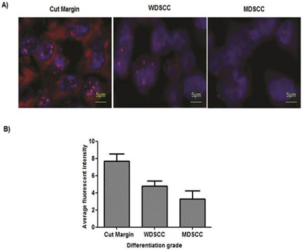 J Cancer Image