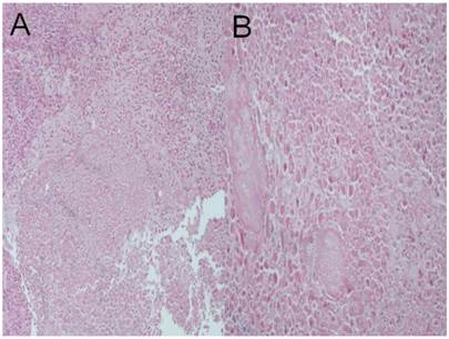 J Cancer Image