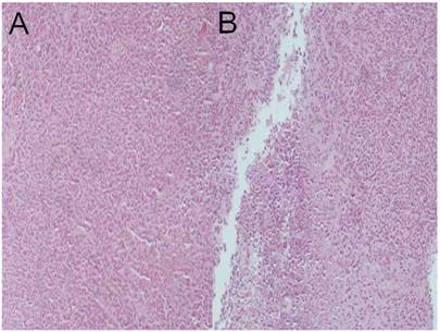 J Cancer Image