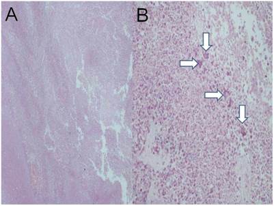 J Cancer Image