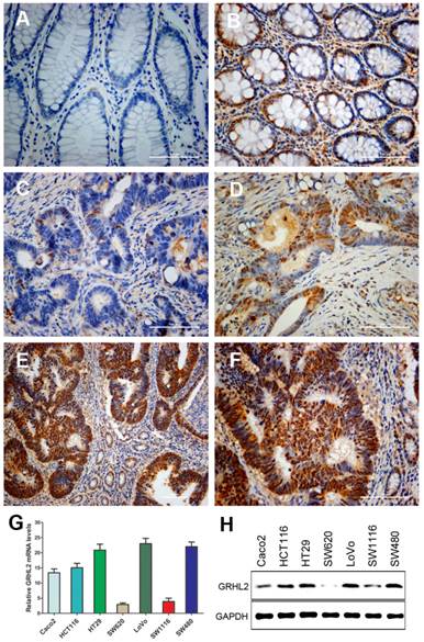 J Cancer Image