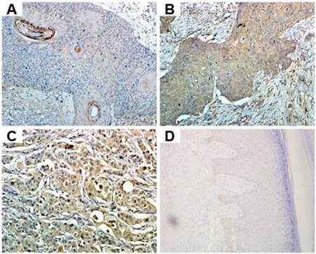 J Cancer Image