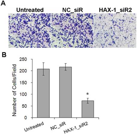 J Cancer Image