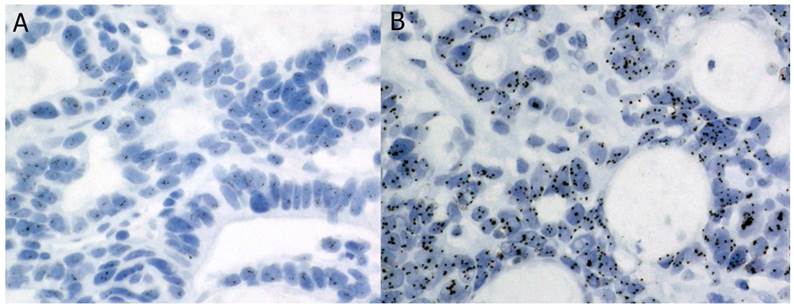 J Cancer Image