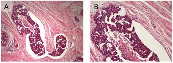 J Cancer Image