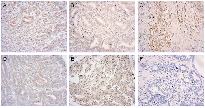 J Cancer Image