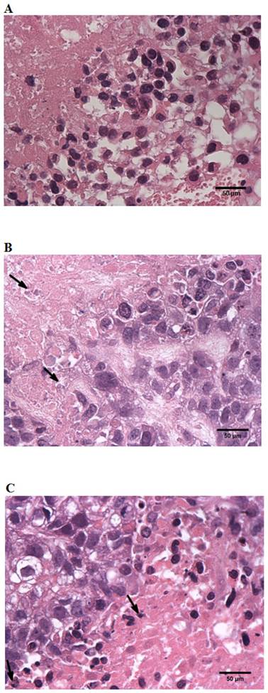 J Cancer Image