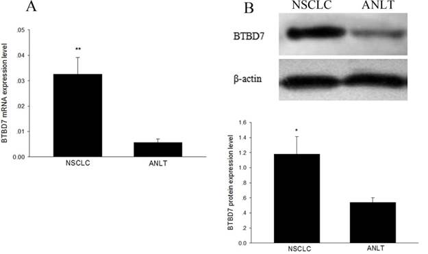 J Cancer Image