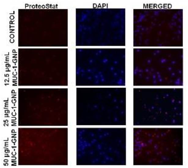 J Cancer Image