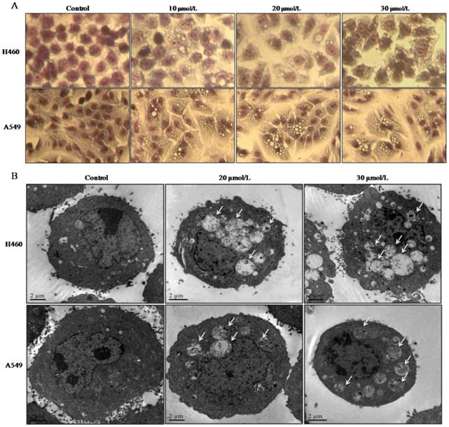 J Cancer Image