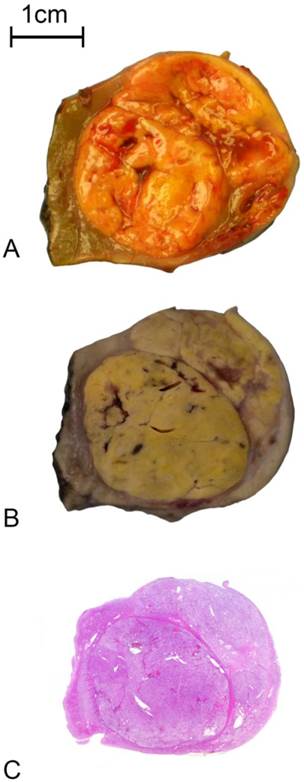 J Cancer Image