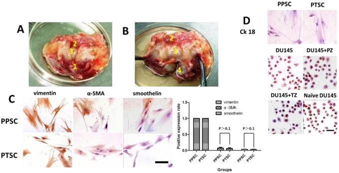 J Cancer Image