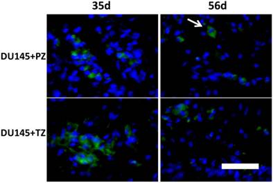 J Cancer Image