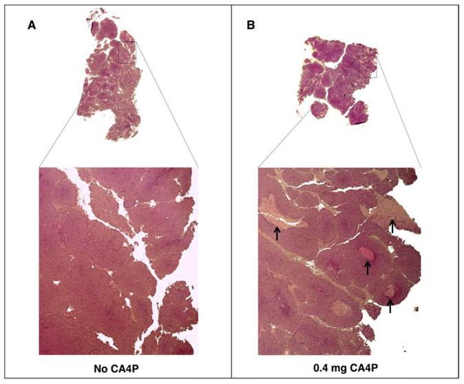 J Cancer Image