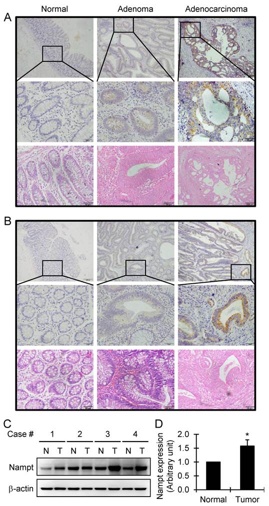 J Cancer Image