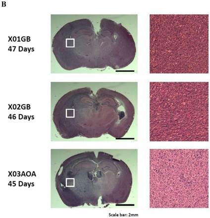 J Cancer Image