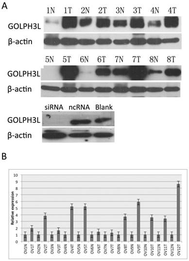 J Cancer Image