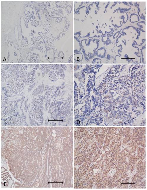 J Cancer Image