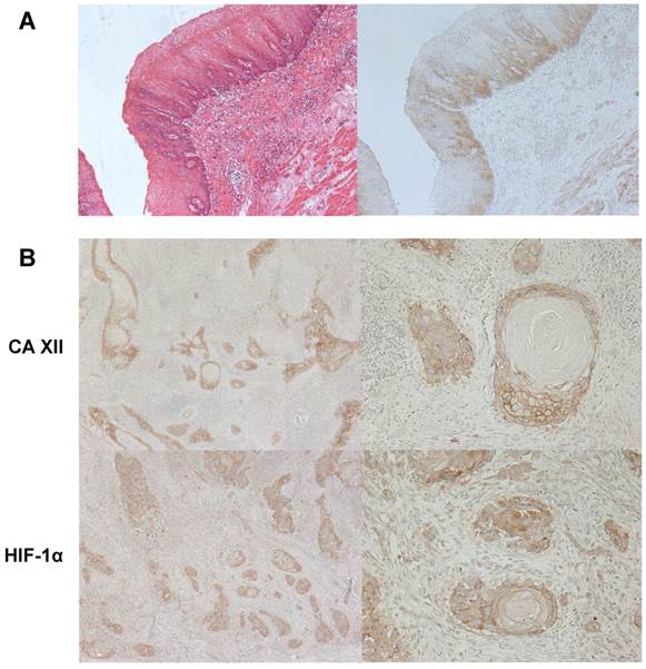 J Cancer Image