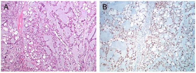 J Cancer Image