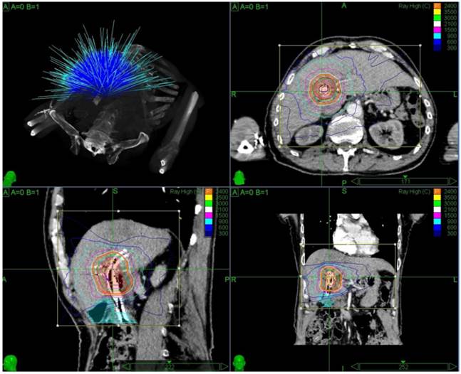 J Cancer Image