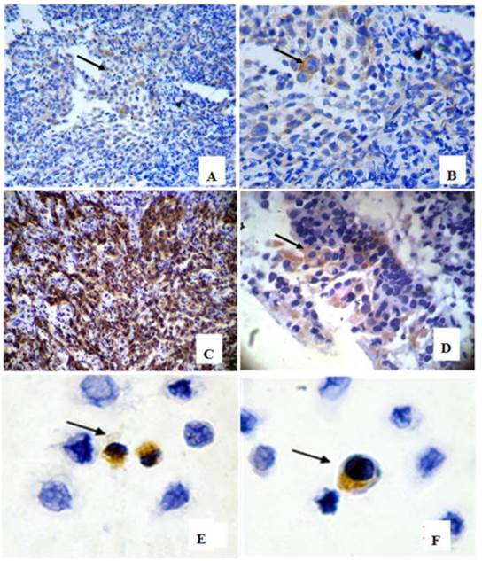 J Cancer Image