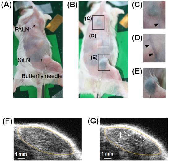 J Cancer Image