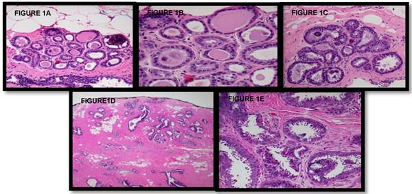 J Cancer Image