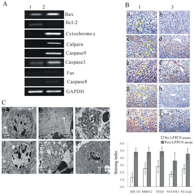 J Cancer Image