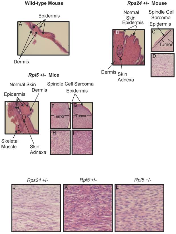 J Cancer Image