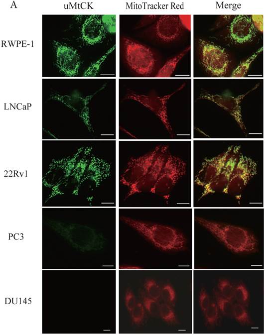 J Cancer Image