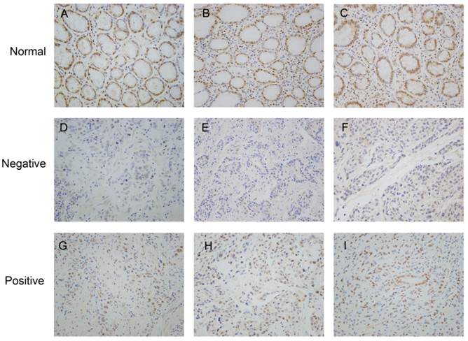 J Cancer Image