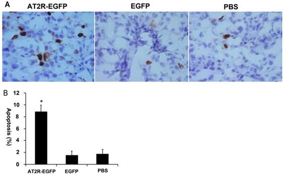 J Cancer Image