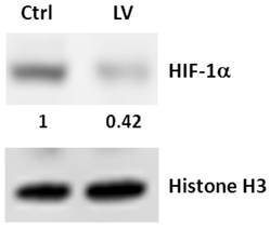 J Cancer Image