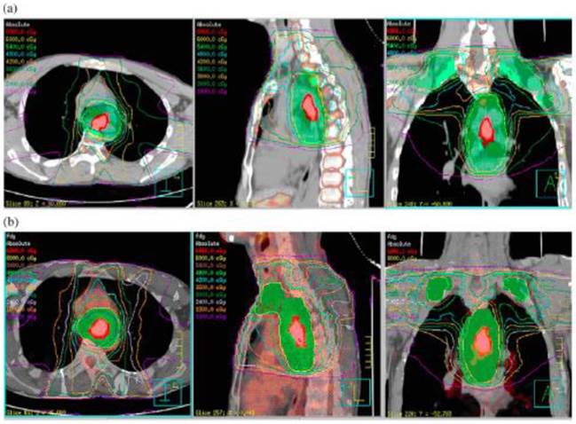 J Cancer Image