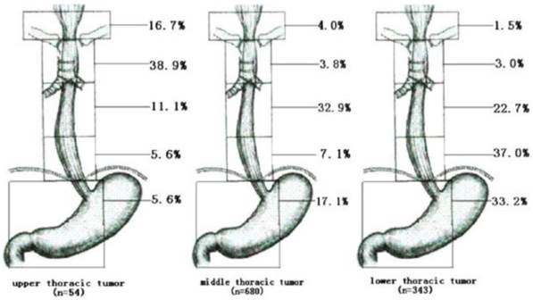 J Cancer Image